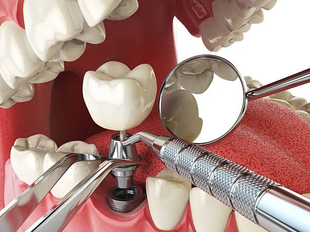 Best Emergency Treatment for Toothache in Larned, KS